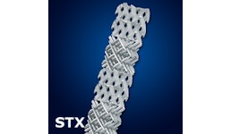 Statischer Mischer Typ STX Statischer Mischer Typ STX