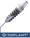 Q-Implant Q-Implant