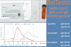 AntiKörper-Test BelTestIT AntiKörper-Test BelTestIT