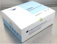 Joysbio SARS-CoV-2 Antigen Rapid Testkit (Collodial Gold) – 20x Speichel- / Spucktest
