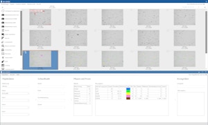 dhs-Basic Software-Kombi-Paket für Bildaufnahme und -vermessung dhs-Basic Software-Kombi-Paket für Bildaufnahme und -vermessung