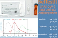 Antikörper-Test Antikörper-Test